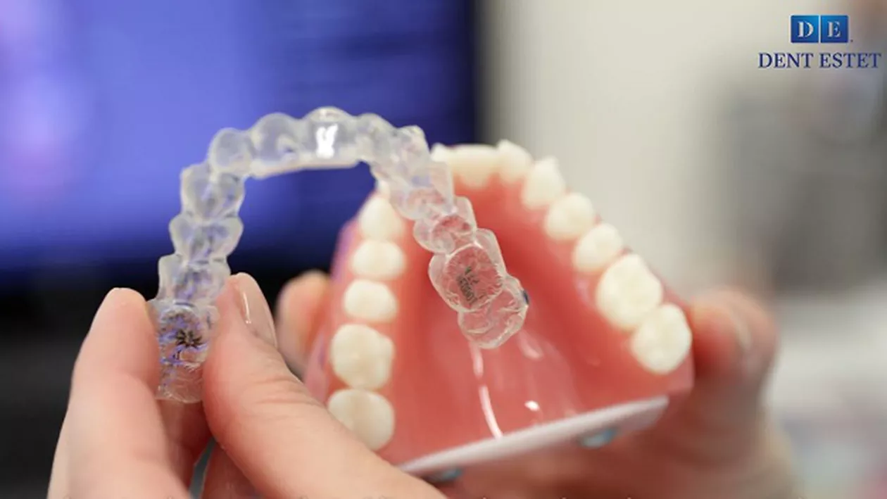 Aparatul dentar Invisalign®️ - o poveste de succes pentru 10 milioane de oameni. TOP 5 beneficii ale Invisalign®️