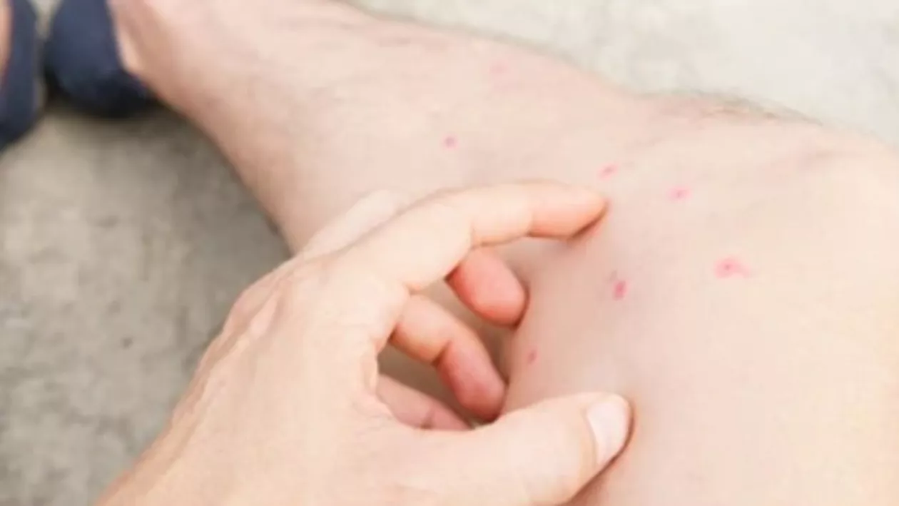 Calvarul prin care trece un bărbat de 35 de ani, după ce a fost mușcat de un purice: Medicii i-au amputat mâinile și picioarele