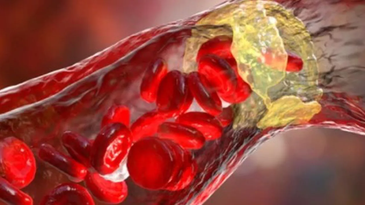Toate bolile cardiovasculare pot fi prevenite prin cel mai ieftin „medicament” / Remediul care reduce cu 50% riscul de a suferi un infarct sau un accident vascular cerebral