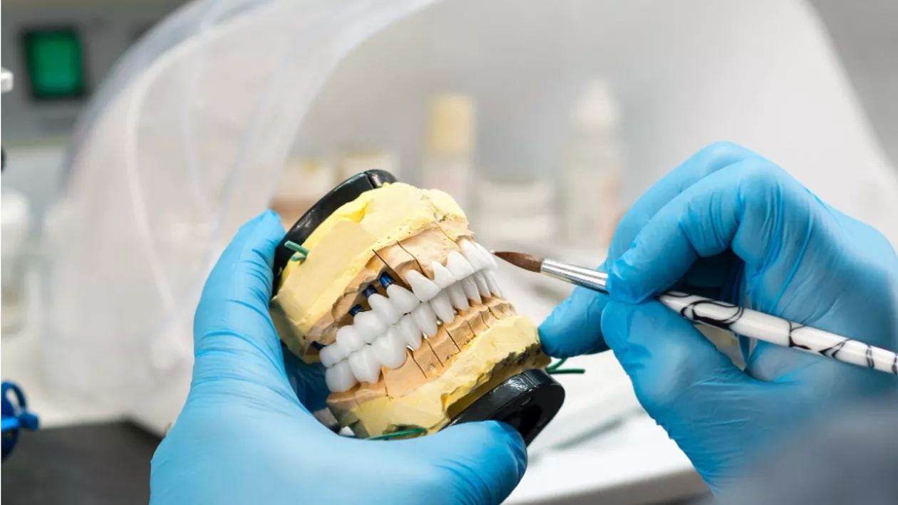Inovația Digitală în Estetica Dentară: Revoluția Fațetelor Dentare No-Prep prin Scanare 3D și CAD/CAM