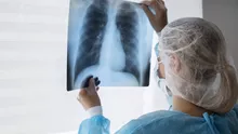 Greu de crezut! Ce au observat specialiștii, în urma unei radiografii pe care i-au făcut-o unui bărbat