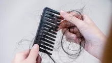 Totul despre căderea părului (Alopecia)