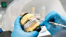 Inovația Digitală în Estetica Dentară: Revoluția Fațetelor Dentare No-Prep prin Scanare 3D și CAD/CAM