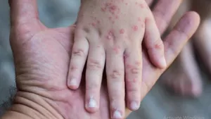 Consecințele mișcării antivacciniste. România, pe primul loc la numărul cazurilor de rujeolă în UE
