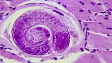 Satu-Mare: Focar de trichineloză într-o comunitate de romi de la carnea de porc