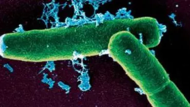 Focar de antrax în Tulcea: Doi bărbați au murit