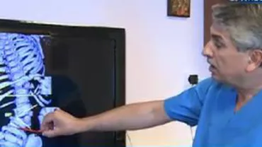 Discipolul lui Pesamosca, Gheorghe Burnei, a efectuat o operație în premieră internațională (VIDEO)