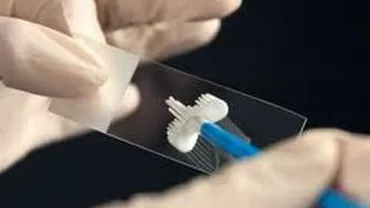Ministerul Sănătății lansează un program de testare gratuită pentru depistarea cancerului de col uterin