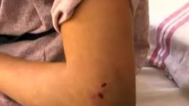 Vaslui: Doi frați de 11 și 13 ani, legați și bătuți de tatăl lor. Au fost salvați înainte să fie uciși cu apă opărită