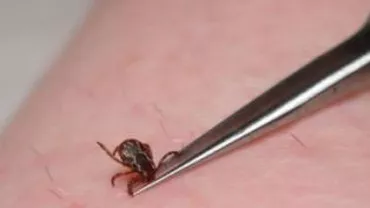 Brățară anti-căpușe, disponibilă pe Internet și în farmacii. Vezi cât te costă să ții insectele la distanță