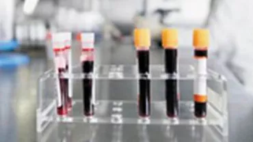 Un bărbat din Iași, operat pentru lichid în pericard, a murit în spital pentru că medicii i-au pierdut analizele