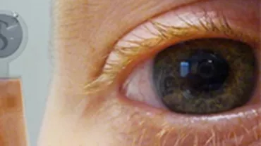 Lentilele de contact cu ecran LCD au devenit realitate