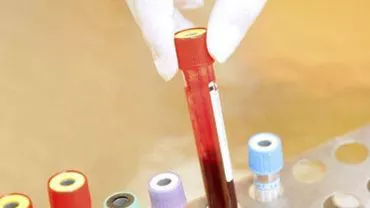 Ministerul Sănătății, sancționat de CNCD pentru discriminarea persoanelor seropozitive