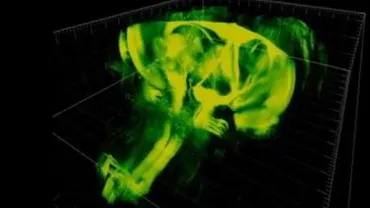 Oamenii de ştiinţă au reuşit să facă transparent creierul unui șoarece, cu ajutorul unei noi tehnologii (VIDEO)