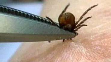 Institutul Național de Boli Infecțioase ”Matei Balș”: La sfârșit de săptămână s-au înregistrat 45 de cazuri cu înțepături de căpușe