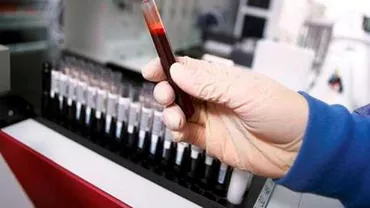 Cercetătorii clujeni au inventat sângele artificial, util în cadrul intervențiilor chirurgicale