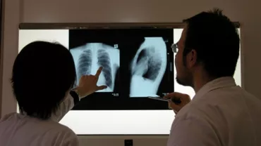 Vaslui: Anchetă epidemiologică la un liceu, după ce o elevă a fost diagnosticată cu tuberculoză