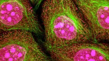 Cercetătorii au creat un test care utilizează căldura pentru a depista cancerul cervical