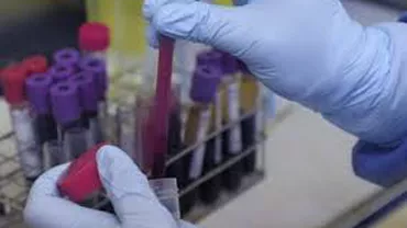 Situație îngrijorătoare la Spitalul de Boli Infecțioase Iași: Bolnavii de HIV/SIDA au rămas fără medicamente