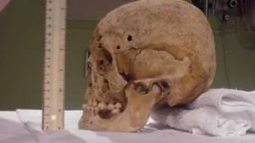 Două cranii umane, găsite la groapa de gunoi a unui sat din Iaşi