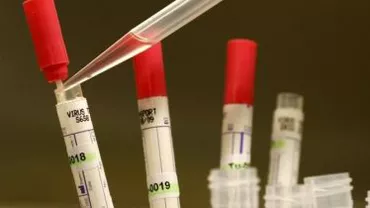 Responsabil medical american: Primul test clinic al unui vaccin împotriva Ebola nu a provocat reacții adverse