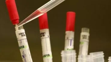 Ministerul Sănătății va primi, la rectificarea bugetară, fonduri de intervenție pentru eventualitatea unor cazuri de Ebola