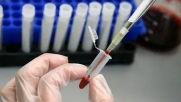 Pacienţii cu HIV/SIDA critică decizia Ministerului Sănătății de a desfiinţa Comisia Naţională de Luptă Anti-SIDA