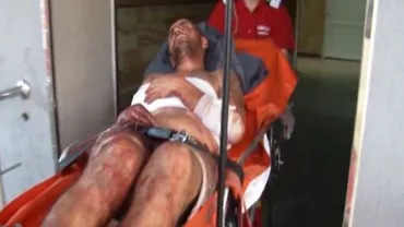 Dâmbovița: Un bărbat de 37 de ani a fost înjunghiat de tatăl său și se află internat la terapie intensivă