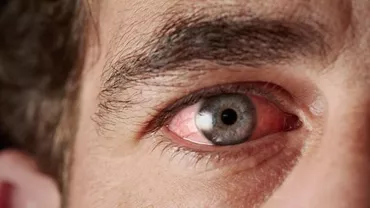 Ochii roșii, fruntea înaltă, piele închisă la culoare: Peste o mie de ani se schimbă înfățișarea oamenilor din cauza schimbărilor climatice și a mutațiilor genetice (VIDEO)