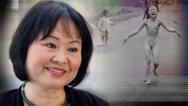 La peste 40 de ani de la tragedie, fetița arsă cu napalm devenită simbolul viu al Războiului din Vietnam va beneficia de tratament pentru tratarea cicatricilor (FOTO)