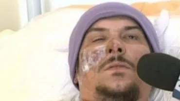 "S-a făcut beznă și s-au auzit urlete. Ca la Auschwitz. Eram unii peste alții, ne înghesuiam spre ieșire". De pe patul de spital, basistul trupei Monarchy povestește infernul de la clubul Colectiv