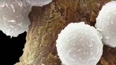 Terapia medicală revoluționară care salvează pacienți în fază terminală de cancer (VIDEO)