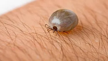 Au reapărut căpușele: Doi buzoieni au ajuns în spital după ce au fost mușcați de insectele parazite