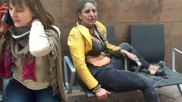 O imagine cu una dintre victimele atentatelor din Bruxelles a făcut înconjurul lumii. Cine este femeia rănită în aeroportul Zaventem (FOTO)