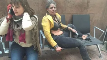 Simbolul atentatelor: Imaginea femeii rănite pe aeroportul din Bruxelles a devenit virală pe internet (VIDEO)