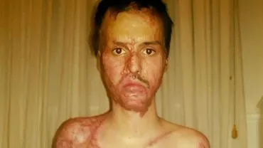 Explicaţia șocantă a mamei acuzată că a fugit cu banii pentru tratamentul lui Alex, ars în Colectiv