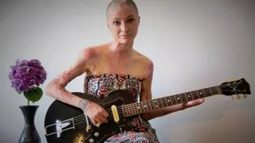 Fotografiile cu Tedy, supraviețuitoarea din Colectiv, la expoziția "Angels", tribut pentru victime (FOTO)