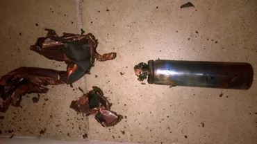 IMAGINI ȘOCANTE. Unui bărbat i-a explodat țigara electronică în față. "Am pierdut cel puțin 7 dinți, arsuri de gradul doi pe față..." (FOTO)