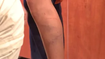 Un copil de 13 ani, bătut cu biciul de iubitul mamei ca pedeapsă pentru o poznă. Vinovatul riscă pedeapsa cu închisoarea