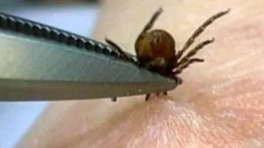 Situație revoltătoare: Fetiță, plimbată între spitale, după ce a fost mușcată de o căpușă. Medicii nu s-au pus de acord cum să o ajute  (VIDEO)