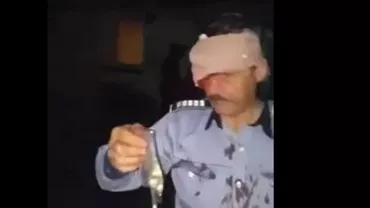 Primele imagini: Cum arată polițistul rănit de un tânăr cu sabia, la Iași (FOTO, VIDEO)