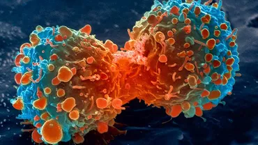 De ce mor atât de mulți români de CANCER? Răspunsul este BANAL, dar cutremurător