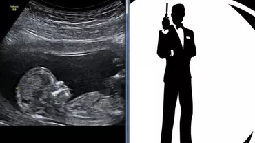 Achiziție inedită la Serviciul de Informații Externe: Spionii își cumpără ECOGRAFE CU aplicaţii de OBSTETRICĂ şi GINECOLOGIE