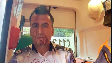 Poliţist din Craiova, bătut crunt de un şofer pe care l-a oprit în trafic (FOTO, VIDEO)