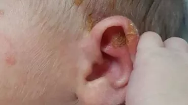 Bebeluș infectat în Spitalul Baia Mare. Decizia dramatică pe care au luat-o părinții