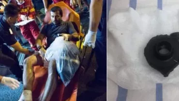 Protestatarul rănit pe 10 august de capacul unei grenade pleacă din România: Țara pe care am dorit să o salvez a decis să mă împuște. La propriu