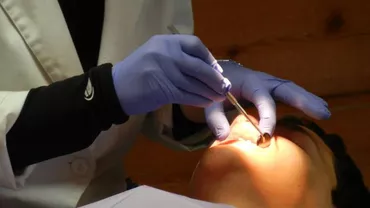 PlazaDent ofera preturi accesibile pentru aparatele dentare