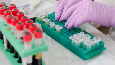 Managerul Institutului Marius Nasta recunoaște că au probleme cu canalizarea de 10 ani! Mahler: `Bucătăria nu poate fi sursa bacteriei. Exclus`