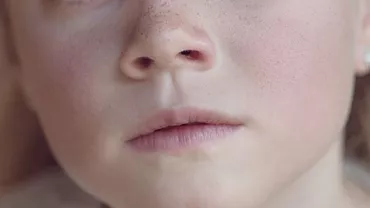 Ce trebuie sa stiti despre rinoplastie