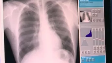 Descoperire neașteptată în Slatina: Trei medici au dosit în vestiare 140 de radiografii (VIDEO)